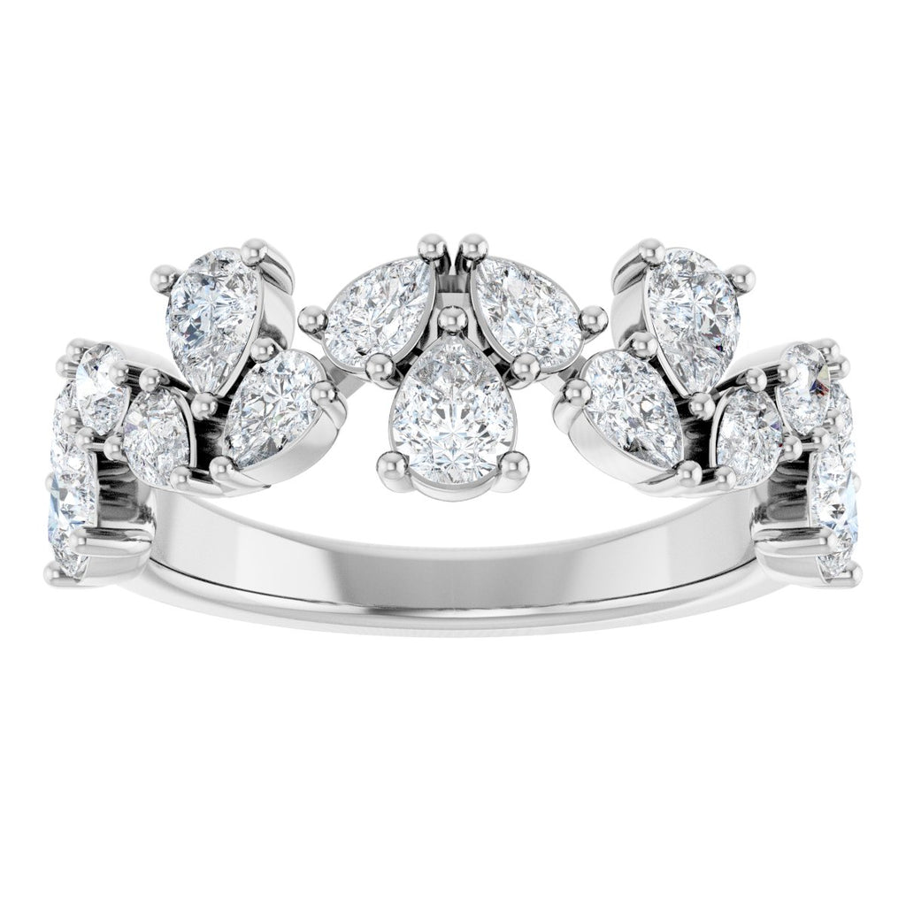 Anniversary Band