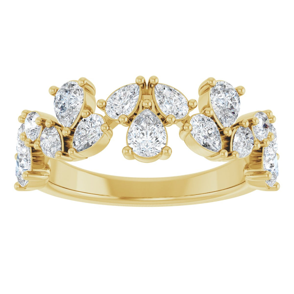 Anniversary Band