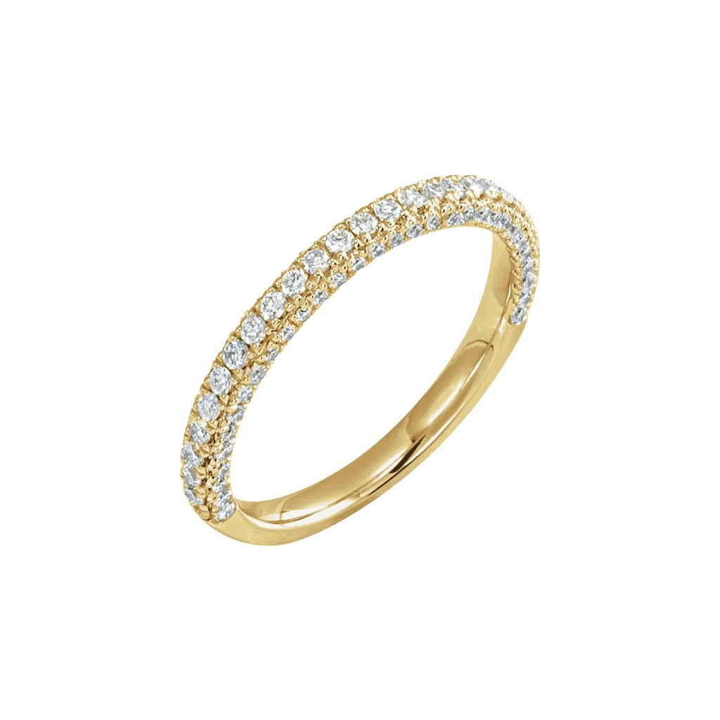 Accented Peg Shank or Band