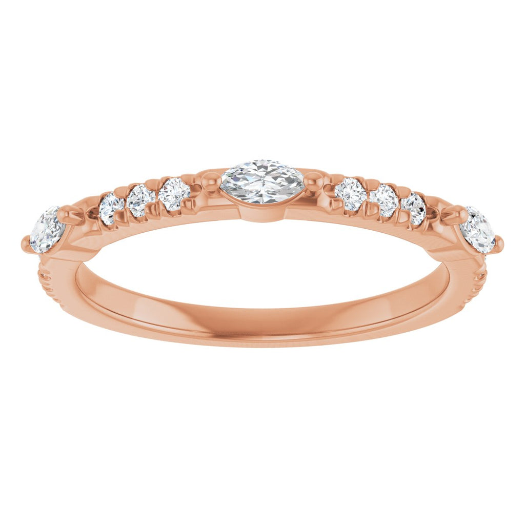 Anniversary Band
