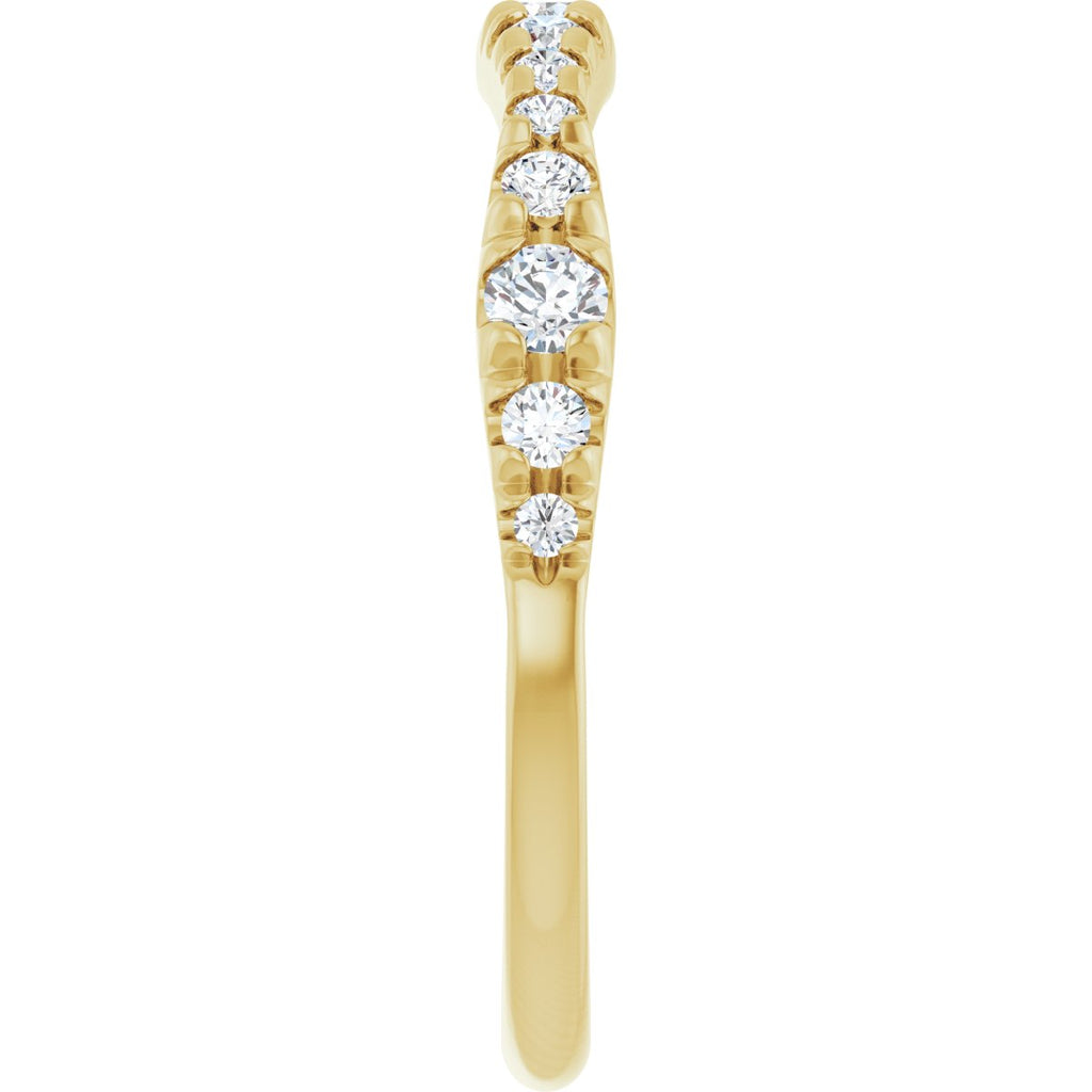 French-Set Anniversary Band